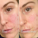 REN - EverCalm sérum apaisant anti-rougeurs pour peau sensible