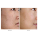 Tata Harper - Resurfacing serum - Sérum resurfaçant éclat