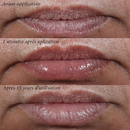 Novexpert - Lip'Up Soin Volumateur Lèvres 
