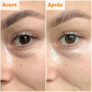 REN - Soin éclat contour des yeux anti cernes