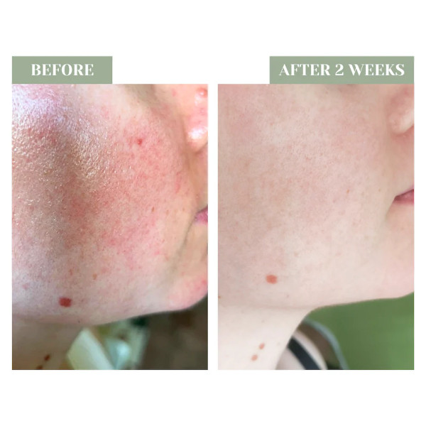 Twelve Beauty - B12 Calm Serum - Concentré anti-rougeurs à la vitamine B12 Twelve Beauty - B12 Calm Serum - Concentré anti-rougeurs à la vitamine B12