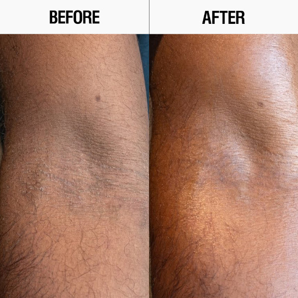 Grown Alchemist - Resurfacing Targeted Body Lotion Grown Alchemist - Resurfacing Targeted Body Lotion