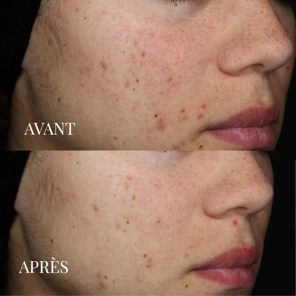 JOD - Masque Soin D&eacute;toxifiant
