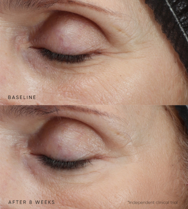 Résultats test et avis sur la Phytomelatonin Rejuvenating Eye Cream d'Irene Forte